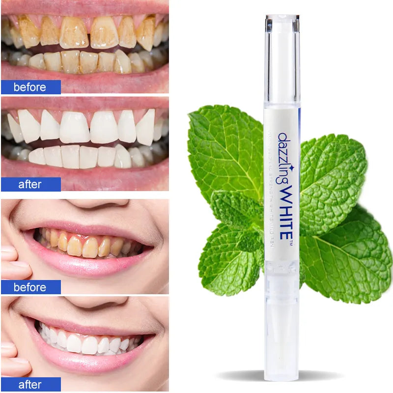 "Teeth Whitening Pen: Stain Removal and Plaque Cleaning Serum"