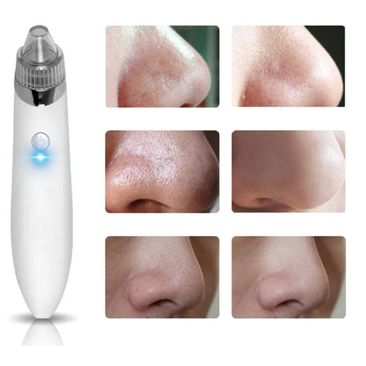 Facial Blackhead Remover Pore Cleaner Vacuum Peeling Dead Skin Acne Remover