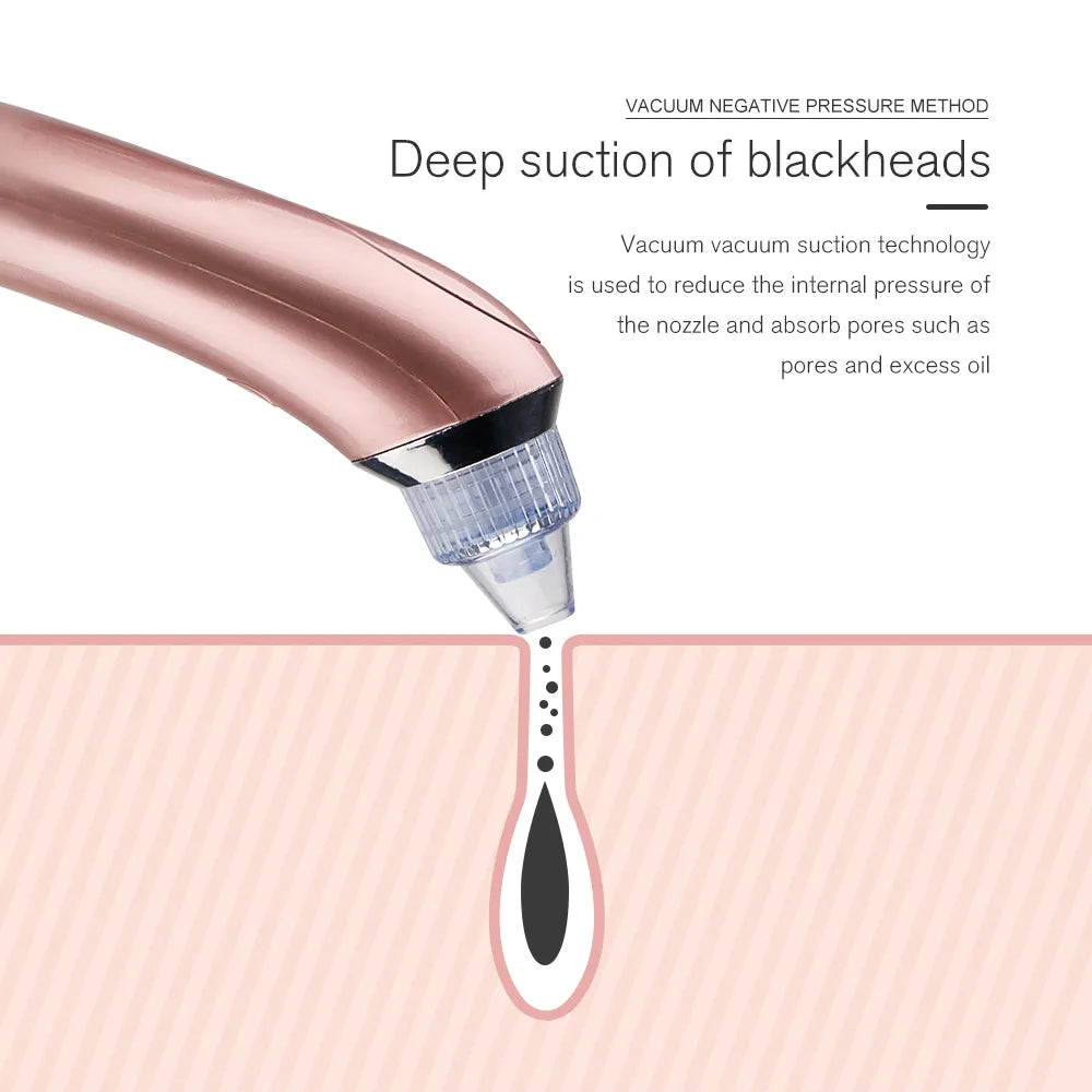 Facial Blackhead Remover Pore Cleaner Vacuum Peeling Dead Skin Acne Remover