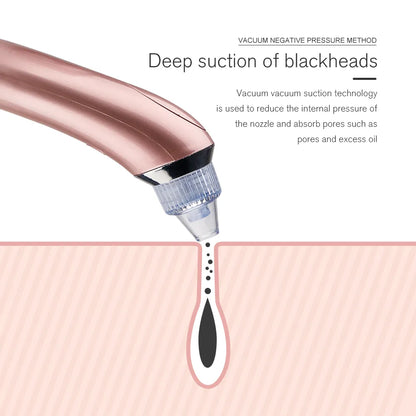 Facial Blackhead Remover Pore Cleaner Vacuum Peeling Dead Skin Acne Remover